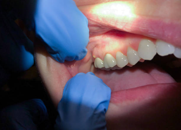Best Cosmetic Emergency Dentistry in New Castle, PA