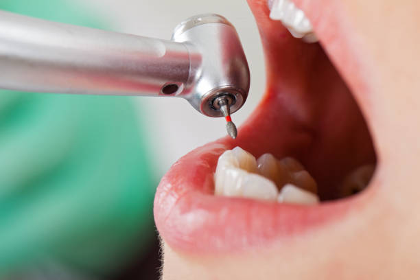 Best Emergency Gum Treatment in New Castle, PA